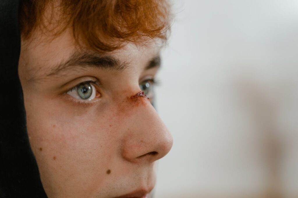 Close-up image of a teenage boy with a nose injury, highlighting detail and emotion.